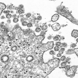CDC image of coronavirus