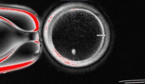 Fertility Research