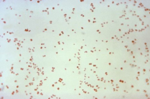 STD Trends