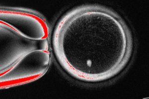 Fertility Research